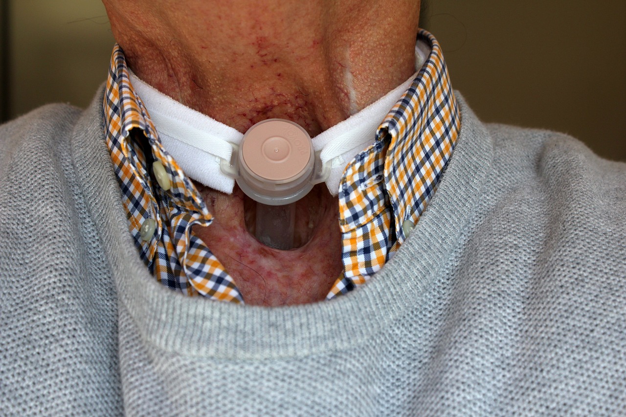What is a Stoma? Understanding Types and Key Differences